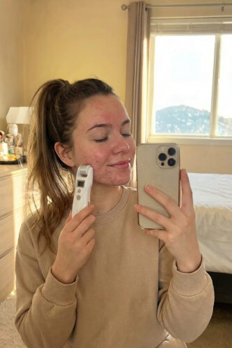 DermaPen, urządzenie do mezoterapii MicroGlow PRO photo review